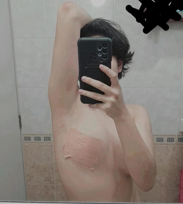 Transtape 5 y 10cm