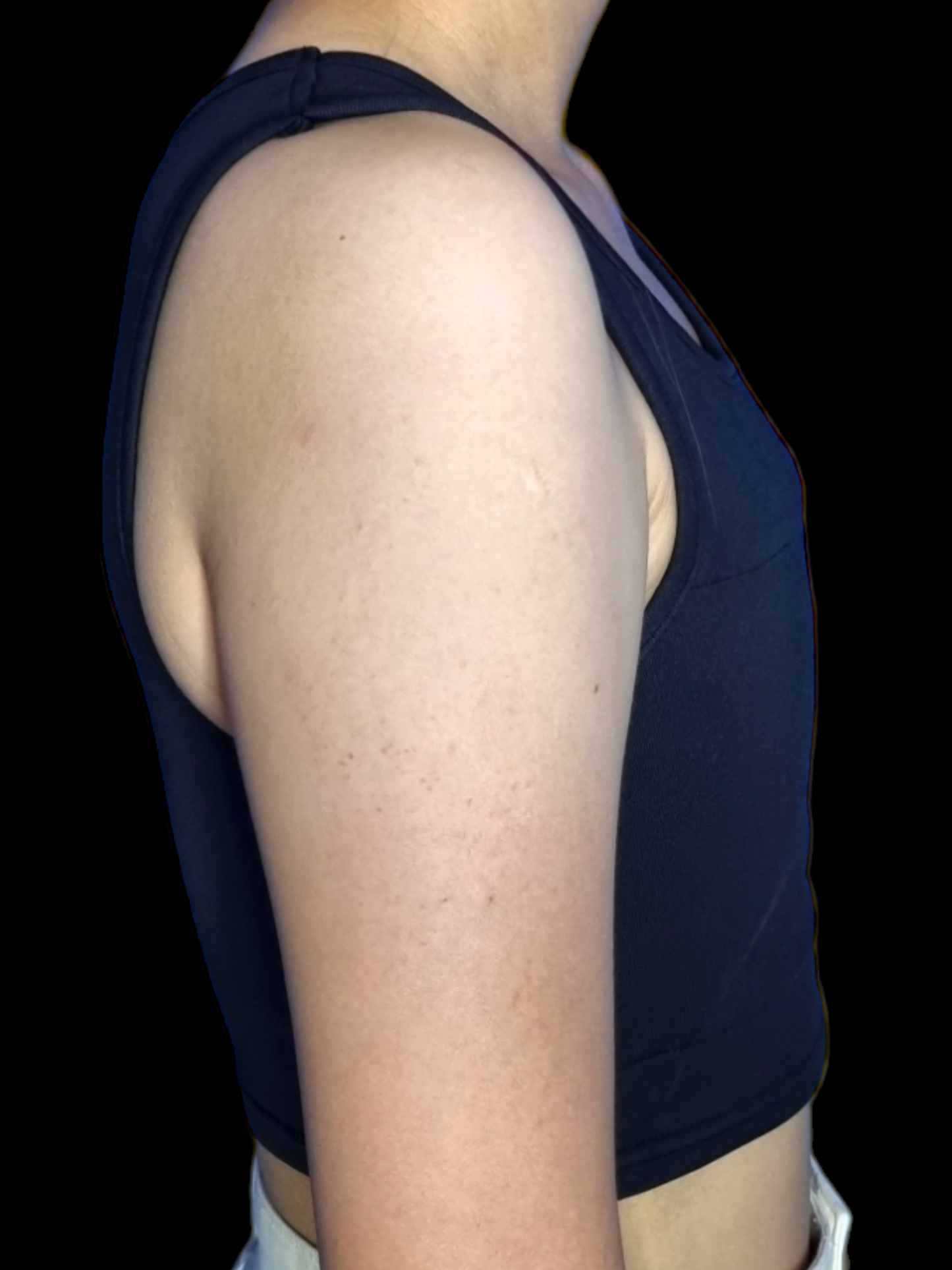 2x1 LIQUIDACIÓN - Binder Corto Sin Ganchillos-Faja para pecho