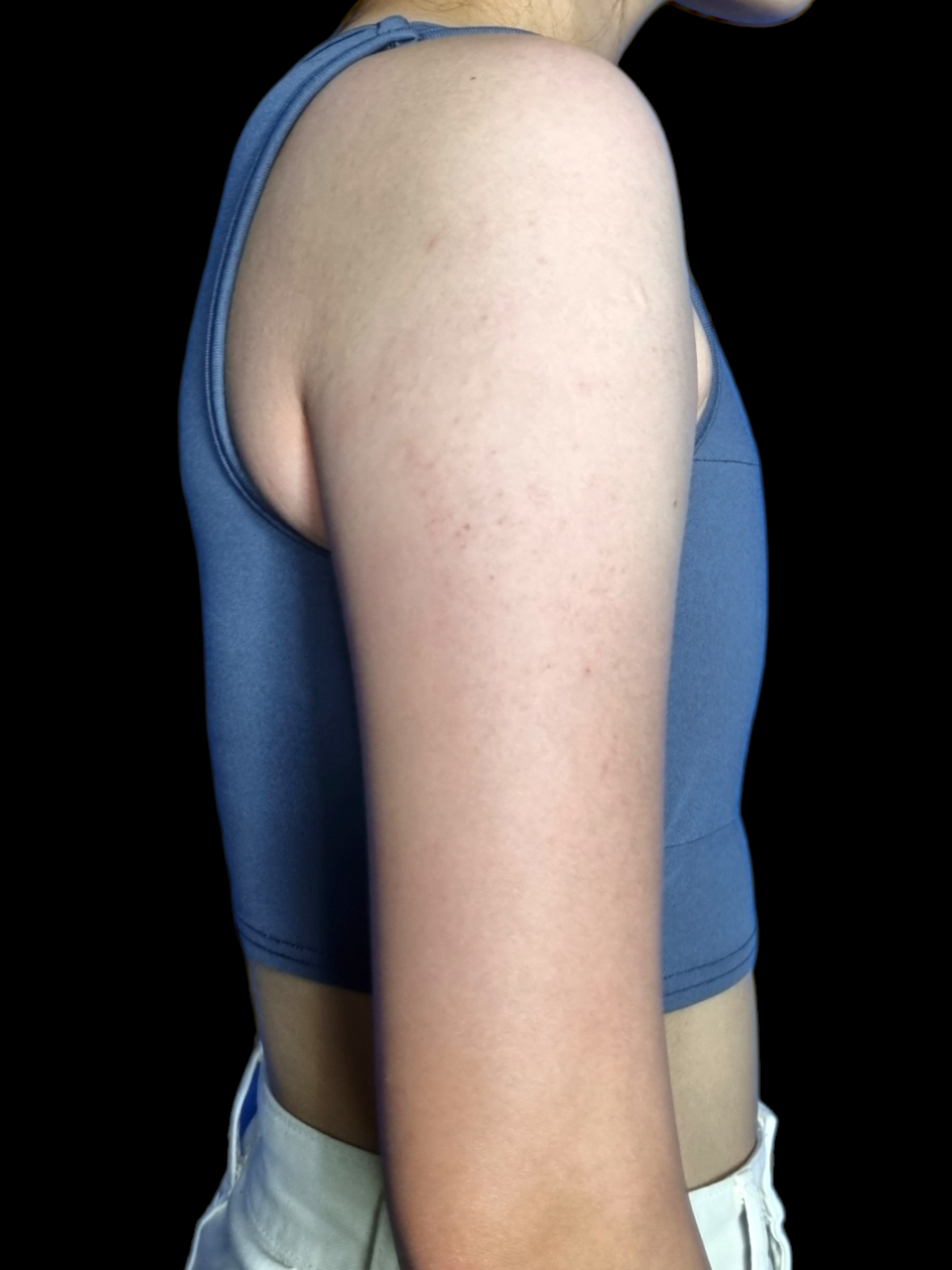 2x1 LIQUIDACIÓN - Binder Corto Sin Ganchillos-Faja para pecho