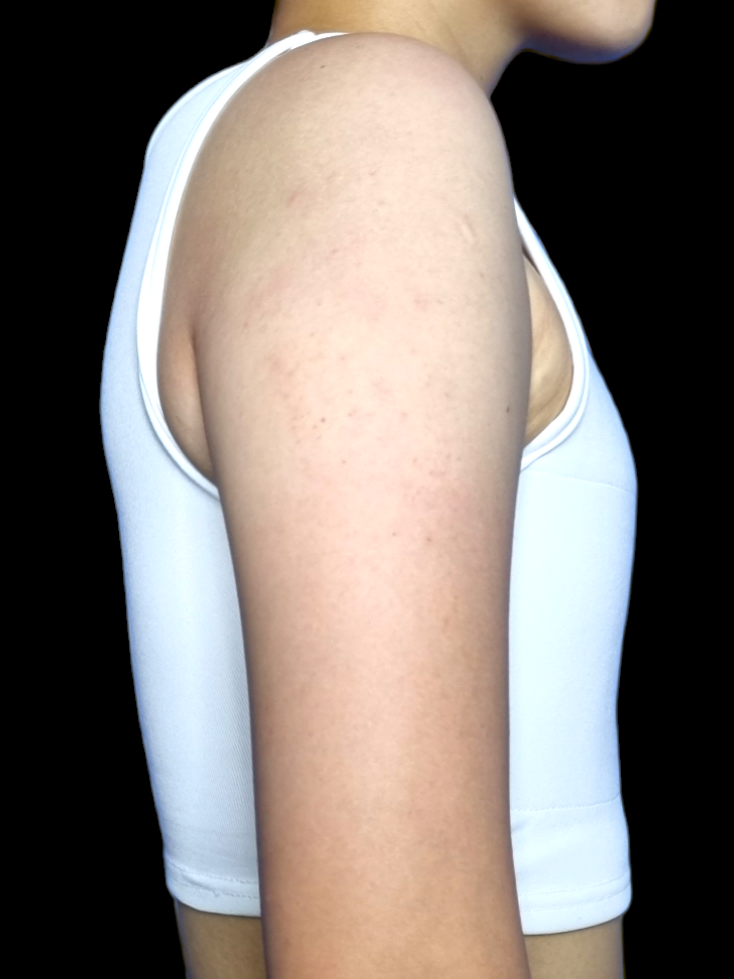 2x1 LIQUIDACIÓN - Binder Corto Sin Ganchillos-Faja para pecho